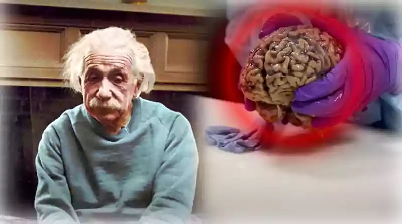 Scientists study Einstein's brain