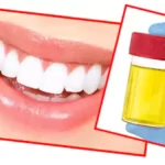 Clean teeth with urine